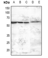 MNK2 Rabbit Polyclonal Antibody