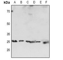 HP1 alpha Rabbit Polyclonal Antibody