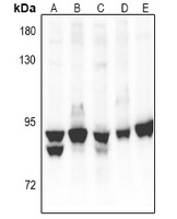 PKC alpha Antibody [KO/KD Validated]