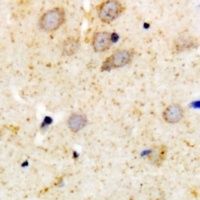 PKC alpha Antibody [KO/KD Validated]