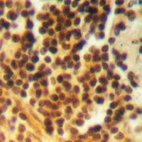 PTK6 (phospho-Y342) antibody