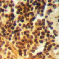 Anti-BRK (Phospho-Y342) Antibody
