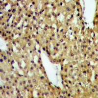 Anti-DAP Kinase 1 (Phospho-S736) Antibody