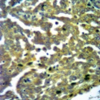 TBK1 (phospho-S172) antibody