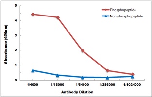 Anti-TBK1 (Phospho-S172) Antibody
