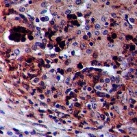Anti-ZAK (Phospho-S165) Antibody