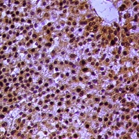 Anti-RXR alpha (Phospho-S260) Antibody