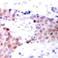 NACA (phospho-S43) antibody