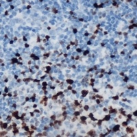 ETS1 (phospho-S251) antibody