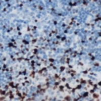 ETS1 (Phospho-S251) Antibody