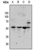 SMAD3 Rabbit Polyclonal Antibody