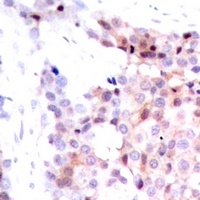 SMAD3 Rabbit Polyclonal Antibody