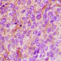 Anti-TBK1 Antibody