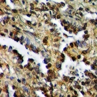 Anti-ZAK Antibody