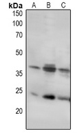 LAT Antibody
