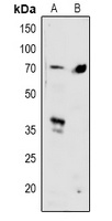 SMAD4 Rabbit Polyclonal Antibody
