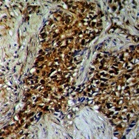 TAB1 Antibody