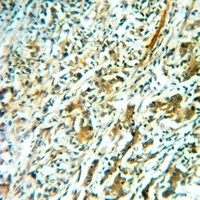 Anti-TAFI Antibody