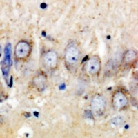 Anti-CSGLCAT Antibody