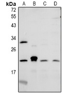 CMTM6 Rabbit Polyclonal Antibody