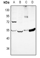 DKK3 Rabbit Polyclonal Antibody