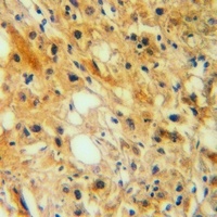 Anti-DKK3 Antibody