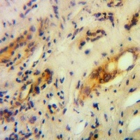 Anti-RNF144B Antibody