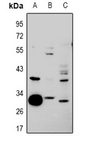 hnRNP CL1 Rabbit Polyclonal Antibody