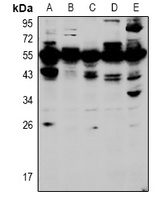 HOXA5 Rabbit Polyclonal Antibody