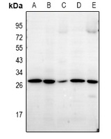 LDLRAD1 Rabbit Polyclonal Antibody