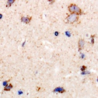 Anti-LRP10 Antibody