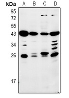 Mannose Binding Protein Rabbit Polyclonal Antibody