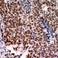 Anti-NARFL Antibody