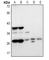 NRBF2 Rabbit Polyclonal Antibody