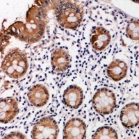 Anti-PI3K p101 Antibody