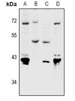 Nectin 4 Rabbit Polyclonal Antibody