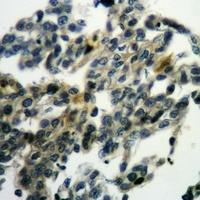 Anti-Nectin 4 Antibody