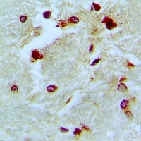 Anti-p46 Antibody