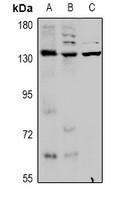 KCNT1 Rabbit Polyclonal Antibody