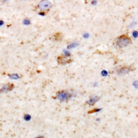 KCNT1 Rabbit Polyclonal Antibody