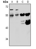 Kv5.1 Rabbit Polyclonal Antibody