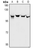 Gemin3 Rabbit Polyclonal Antibody