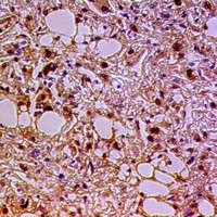 Gemin3 Rabbit Polyclonal Antibody