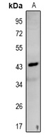 NDRG3 Rabbit Polyclonal Antibody
