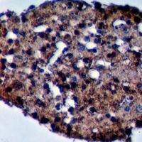 Anti-MYPT3 Antibody