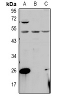 PPM1L Antibody