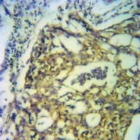 Anti-PPM1L Antibody