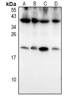 S100-P Antibody