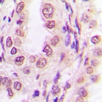 S100-P Antibody