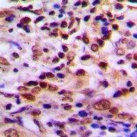 Anti-PDXDC1 Antibody